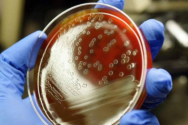 為什么注射青霉素前要做皮試,青霉素皮試過(guò)敏怎么辦