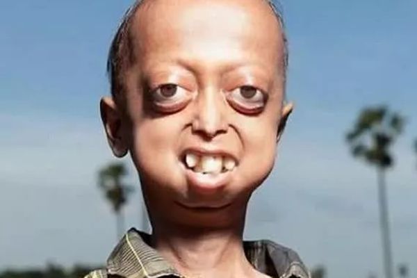 近親為什么不能結(jié)婚,近親結(jié)婚的危害有哪些